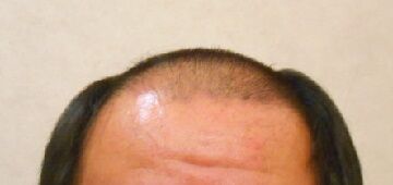 我慢出来なくて・・・。(6)