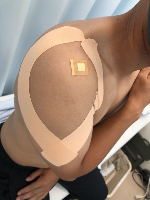 1710169A-A0DF-4044-828A-59CC0EC305E0