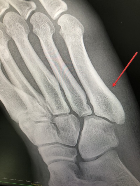 16BB68AF-3CB2-4BC7-A9F3-106F80CA3137