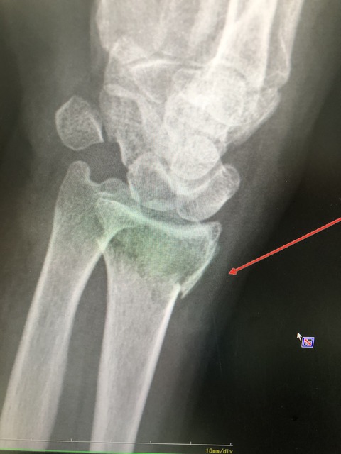 A38ED3A7-551B-4294-A94D-C8ADF46F558C