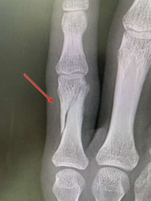 860700C7-DB19-424E-BEA5-20EB30133AE7