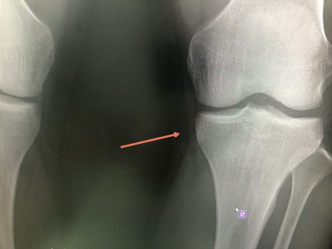 C5135E3C-C4D6-4FF2-AC60-877C7AEDACB1