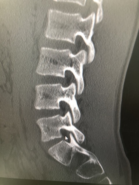 6E603855-8ECA-40D2-8FEC-BEE235669945