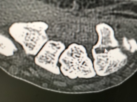 6AAF758A-4280-4B98-89C3-FB116E6DC88B