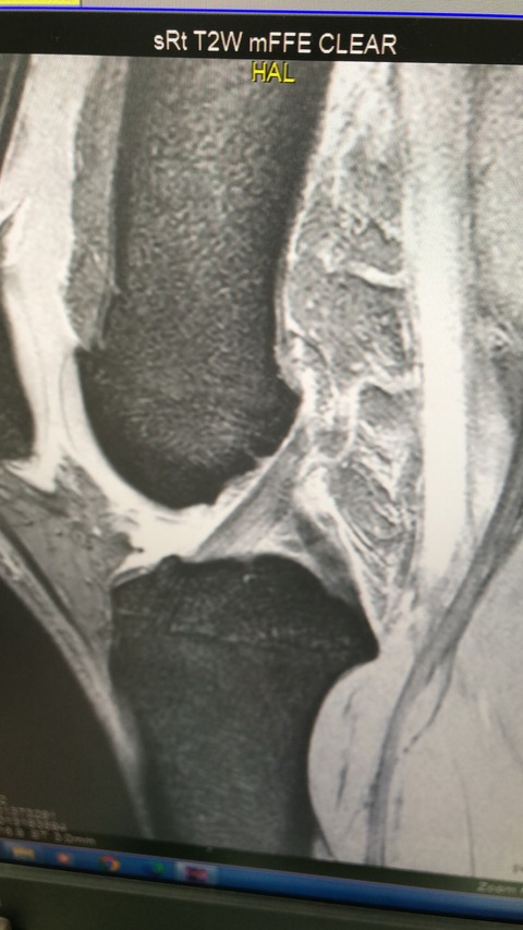 76F5A36A-2079-41F1-9733-FAB41998C539