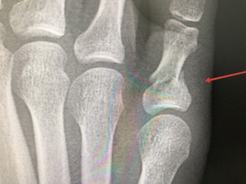 3A117F3D-CEEA-46B1-83A1-1DC9E2579B3C