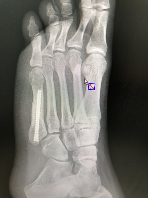 AAF70ECB-3DC2-4E51-B41E-8B547A77474E