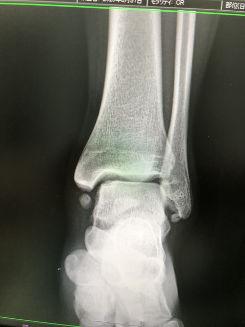 F2CF68CD-052F-4772-A9BA-58FE1BA990BA