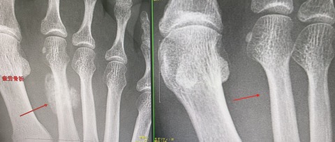 AC48D21C-1281-44E4-BC3B-C561E34DCB69