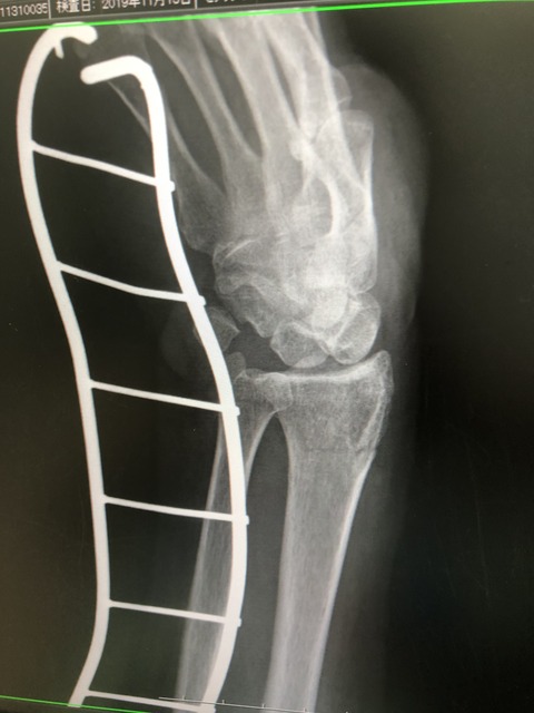 9AAD72DB-769C-4503-AC38-A110E47164CF