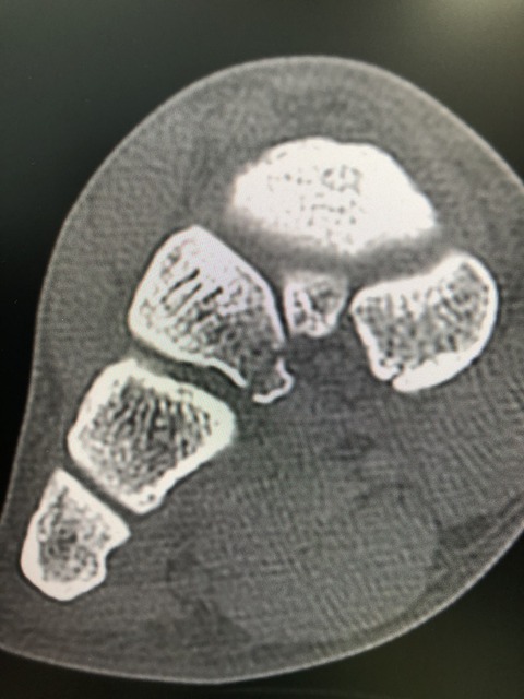 A65DBBCF-EB84-420F-B19E-0D84867FF51F