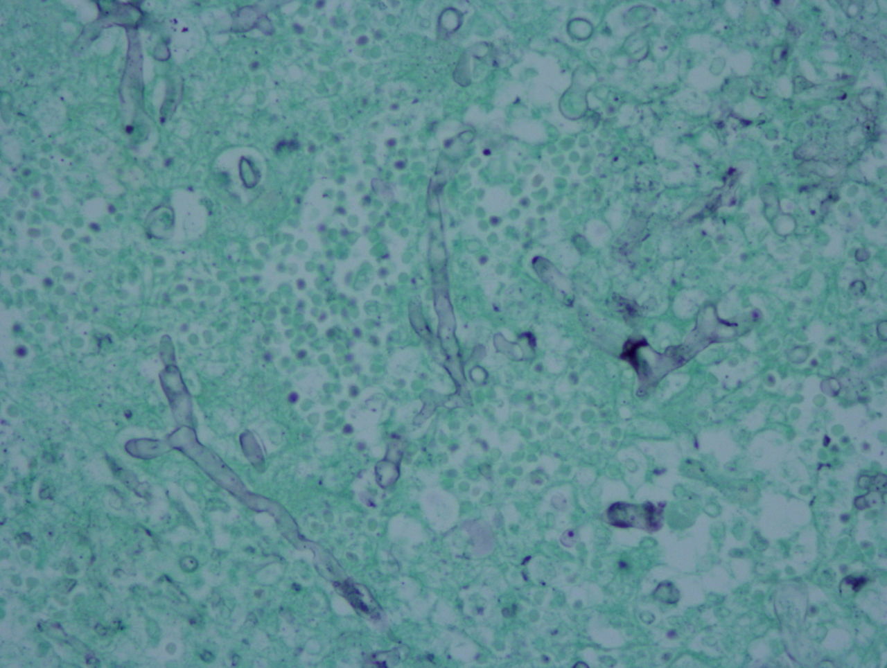 感染症の病理学的考え方
接合菌症の病理はムコール目までの同定に留まる
コメントトラックバック 砂川恵伸