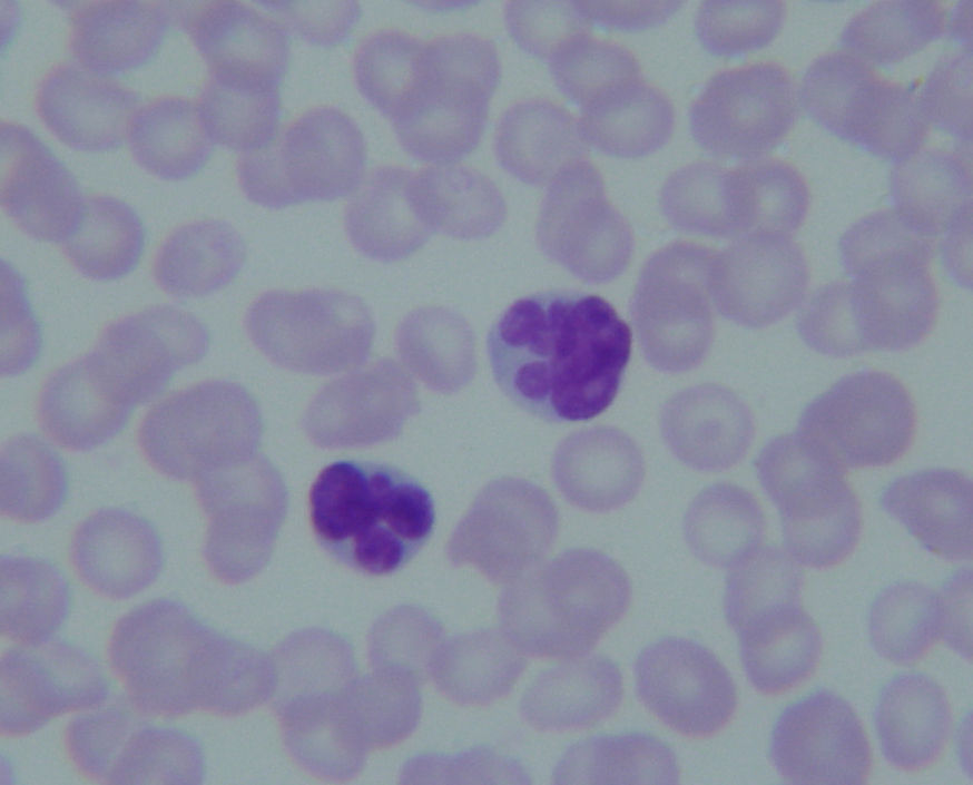 感染症の病理学的考え方
骨髄異形成症候群はWHO分類で芽球20%を越えると白血病
コメントトラックバック 砂川恵伸