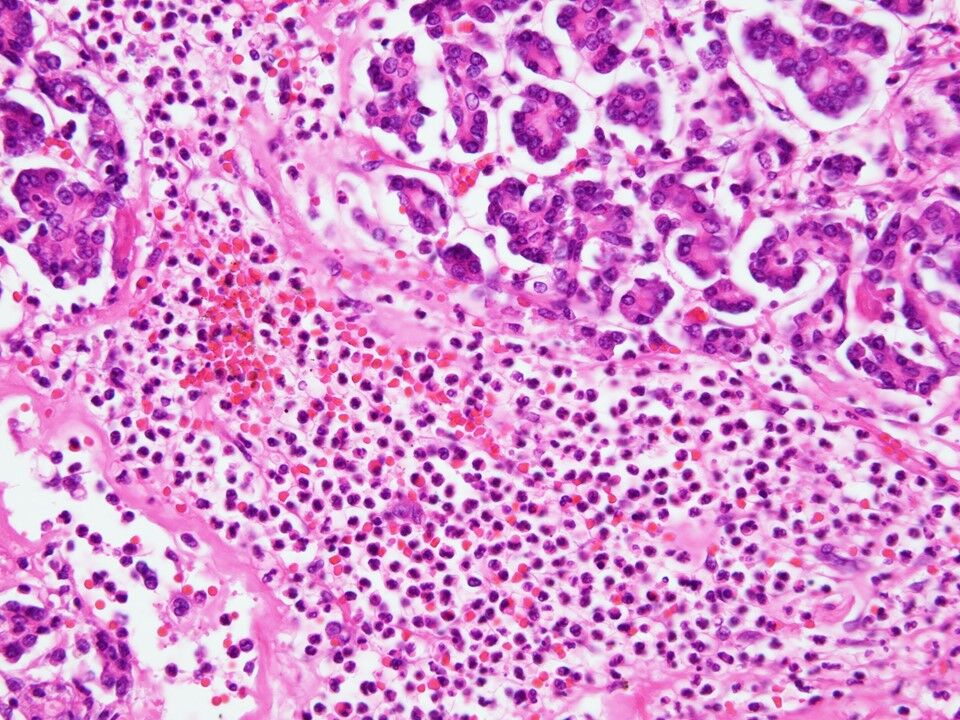 ���饤��22