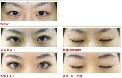 SnapCrab_NoName_2017-4-4_4-20-42_No-00