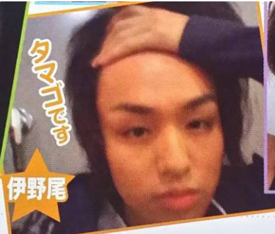 女子の反応 伊野尾慧 テレビで髪を上げ おでこを披露 いや まだ手で隠してる もっと広いはず ガールズ速報 がるそく 女子の反応 伊野尾慧 テレビで髪を上げ おでこを披露 いや まだ手で隠してる もっと広いはず ガールズ速報 がるそく