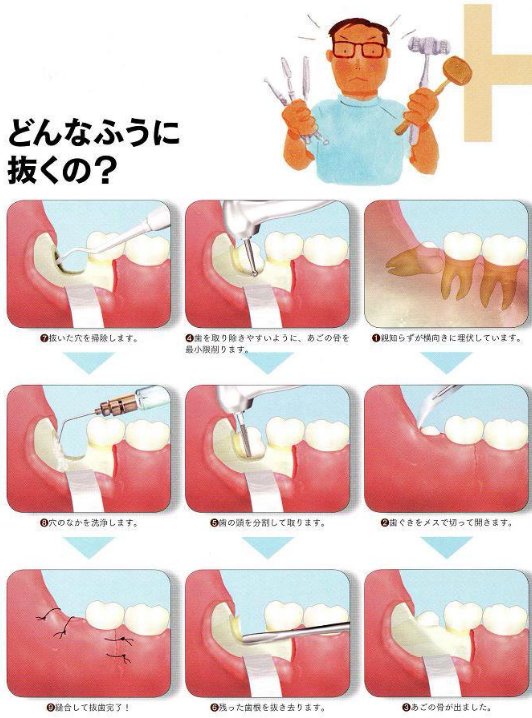動物画像無料 上親知らず イラスト 動物画像無料 上親知らず イラスト