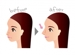 SnapCrab_NoName_2017-4-4_4-25-15_No-00