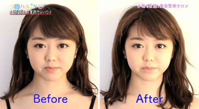 画像 ライザップで痩せたakb48峯岸みなみがリバウンドしてる ガールズ速報 がるそく