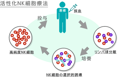 活性化NK細胞療法
