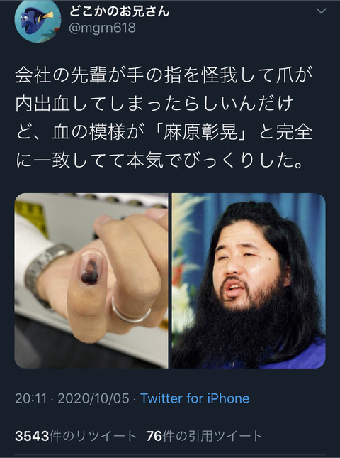 悲報 まんさん 爪に麻原彰晃現れた 笑 パシャ 画像あつめーる 悲報 まんさん 爪に麻原彰晃現れた 笑 パシャ 画像あつめーる