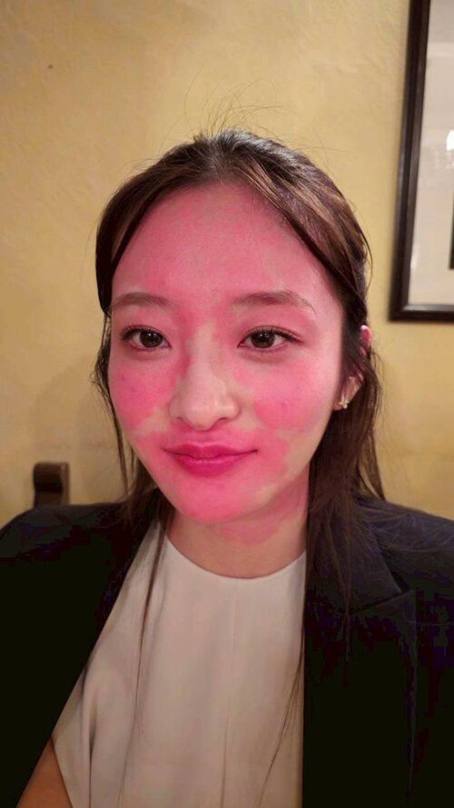 ビールを飲んで顔に異変　現役東大院生モデル・神谷明采、アレルギー検査で「あなたは遺伝的に」