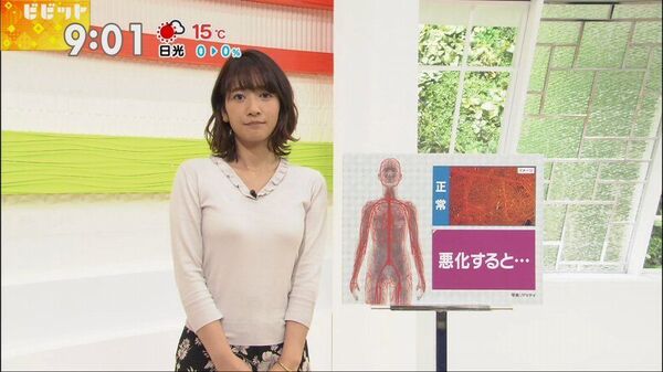 ezgif-5a3a90b54506d30b