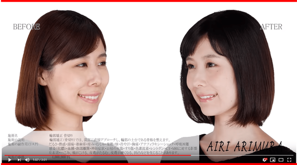 AA1