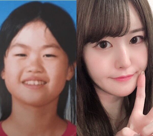 整形youtuber 轟ちゃん 顔に１千万円 成功率は3割 芸能スキャンダルまとめ速報