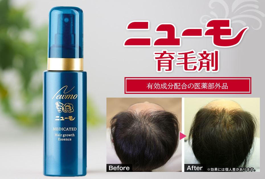 ハゲ朗報 育毛剤 ニューモ が爆売れと話題にｗｗｗｗｗｗｗｗｗ 芸能dx全集中まとめちゃんねる