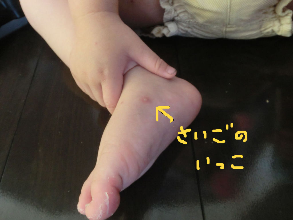 水疱瘡 ８日目 決戦は明日！ : （有）働く母さん