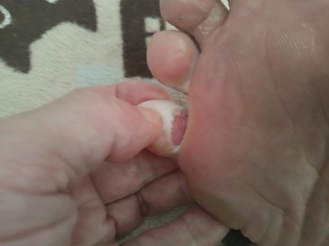 KIMG20250327_144444699