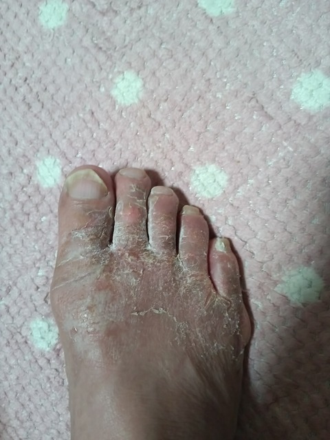 KIMG20250407_194346665