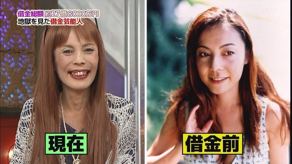 O O 劣化の激しい有名人 O 厳選まとめ O O 劣化の激しい有名人 O 厳選まとめ