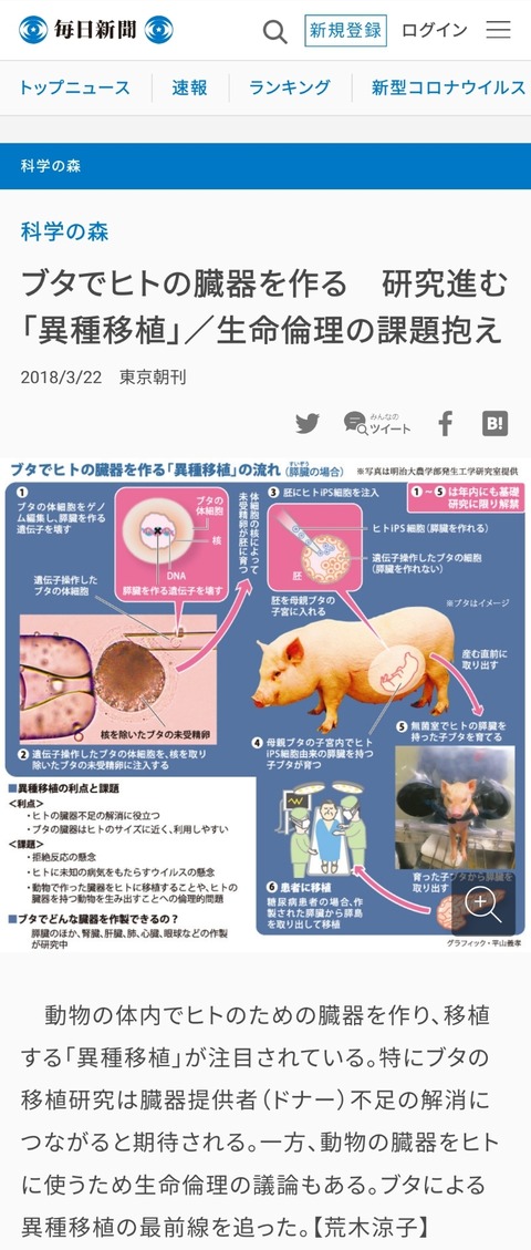 ヒト種さん 豚の腎臓を移植して延命出来る技術を成功させてしまう ジオろぐ