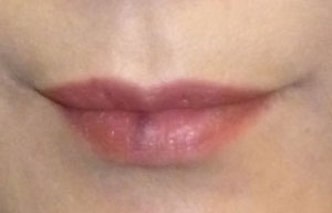 どんな噛み方をするとこんな血豆ができるのか ｊｉｎのアリバイにならない日記