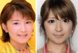 目尻切開 たれ目整形してる芸能人 がーるずとーく 目尻切開 たれ目整形してる芸能人 がーるずとーく