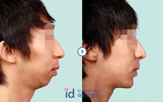 芸能人の横顔が見たい がーるずとーく