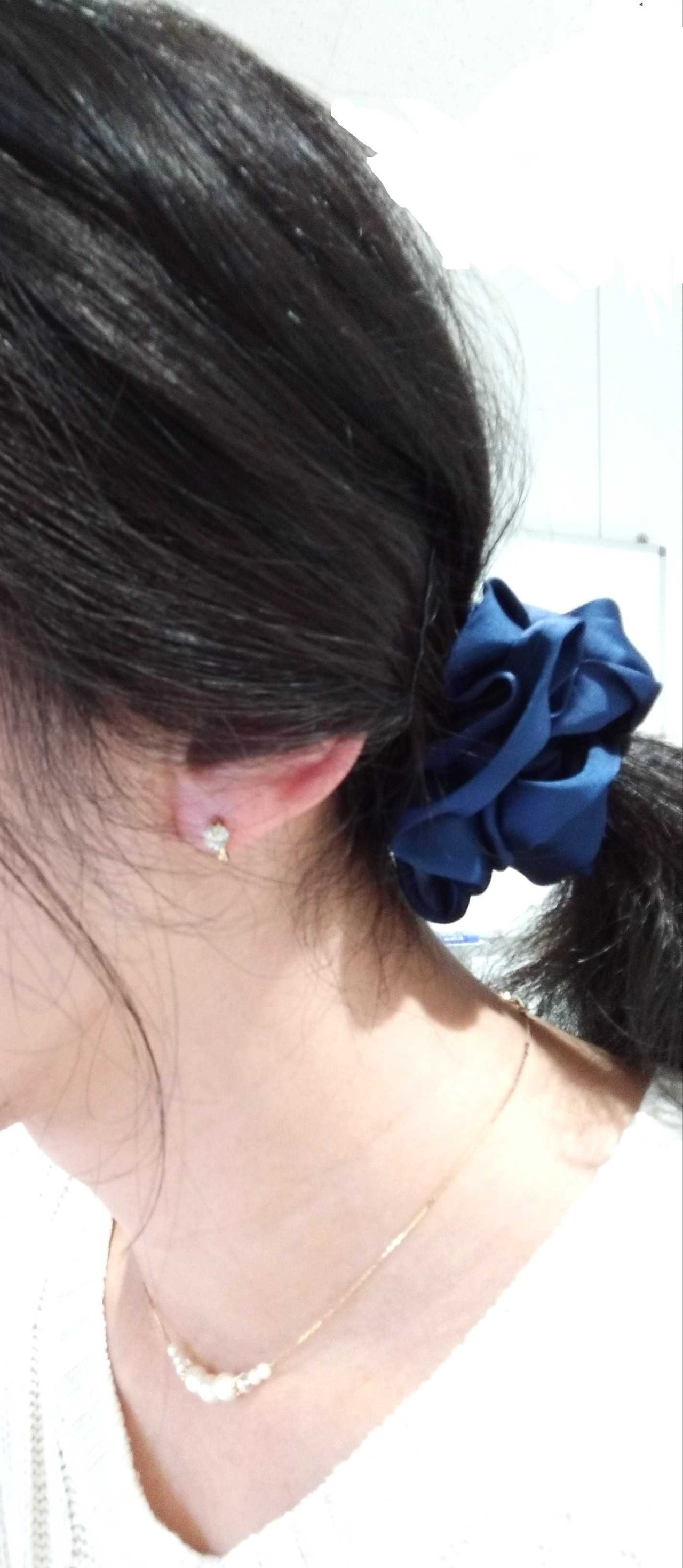 アラフォーmtf 理奈 のホルモン治療８回目 Girlsme 理奈 のmtfブログ