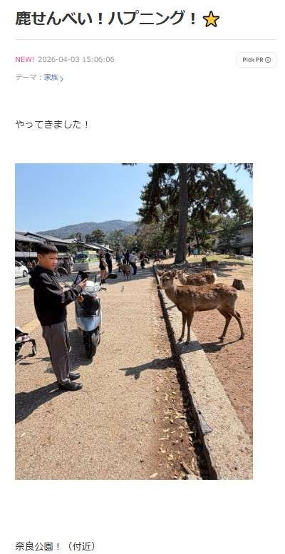 小原正子、息子が奈良公園の鹿に顔を蹴られ「鼻から目の下　山なり足形」顔に跡がクッキリ