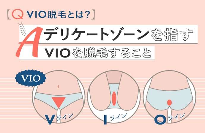 大学生のVIO脱毛は普通？