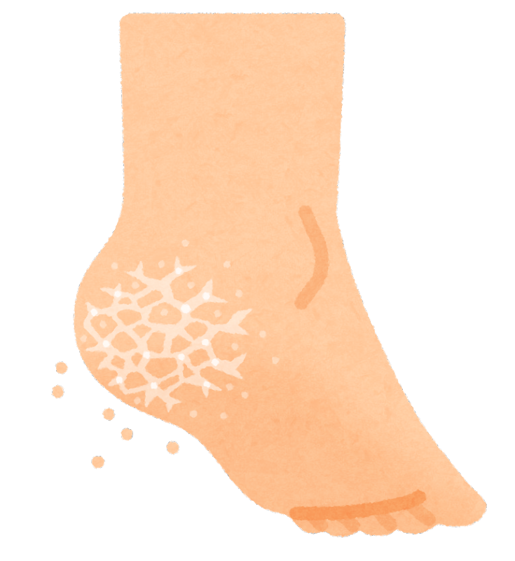 【踵】かかとガッサガサ問題