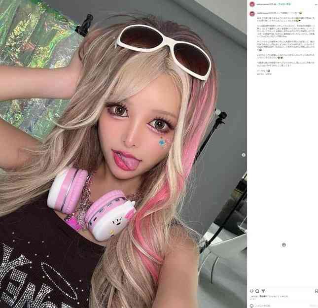 学生時代「ブスな犯罪者」呼ばわりも...「ここまで変われた！」　人気モデルが卒アル公開、激変ぶりにファン驚き