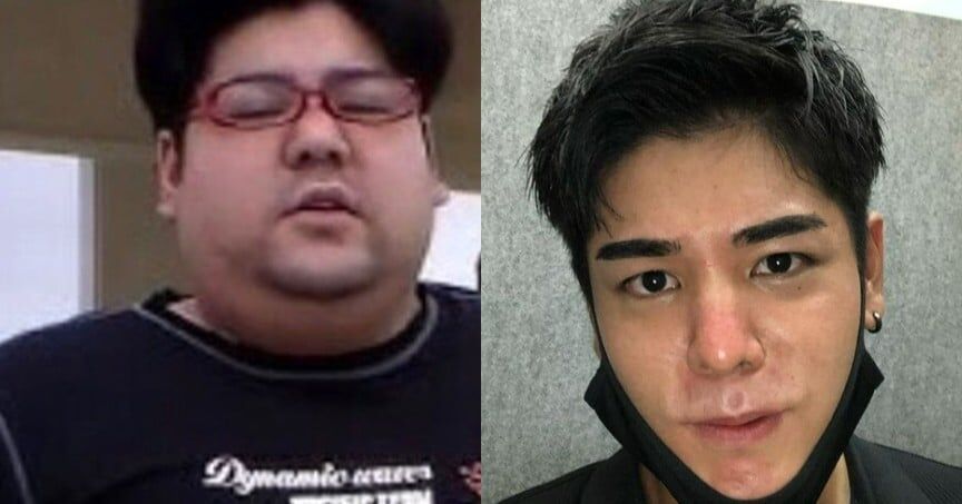 「道を歩けば“気持ち悪い”と…」70kgの大減量で別人になった男性が明かすルッキズムへの想い