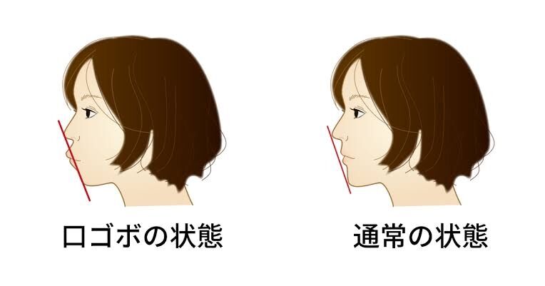 口ゴボの人が少しでも綺麗に見せるには？