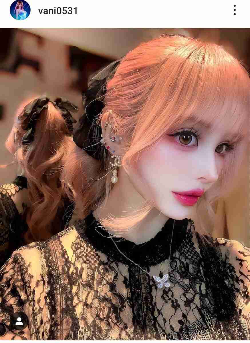 “美容整形に3億円超”で話題のヴァニラ、現在の姿に衝撃「美しい」