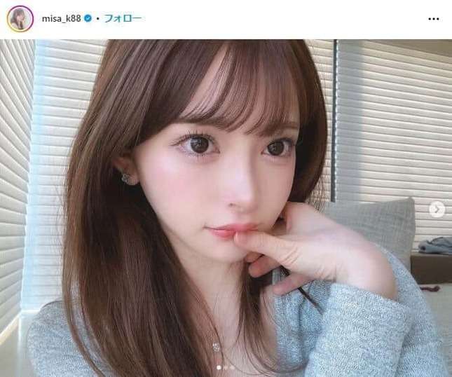 双子ママのインフルエンサー・黒崎みさ、「自然な顔にしておけば」後悔...整形2000万超　「数年前に戻れるなら...」