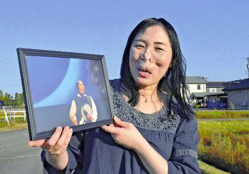 生まれつき鼻と口に変形がある私　「表に出ては駄目」から「隠れなくていいんだ」に変わった理由