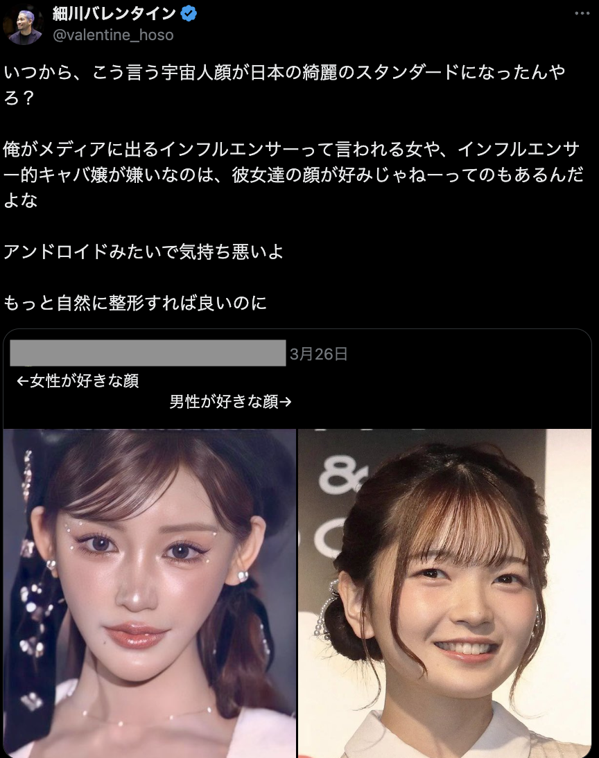 明日花キララ「宇宙人顔」呼ばわりされ”論争”に…「宇宙人かゴリラ顔だったら宇宙人の方が…」