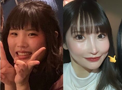 元彼に“ブス”と振られた女性が1800万の整形でたどり着いた生き方「自分を変えられるのは自分だけ」